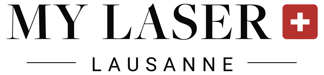 MY LASER - Lausanne - logo noir